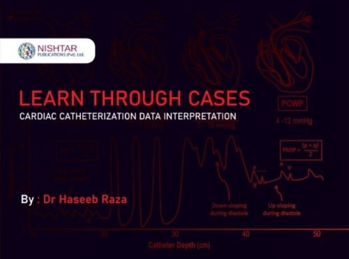 Learn-Through-Cases-Cardiac-Catheterization-Data-Interpretation-Dr-Haseeb-Raza-500x371-1.jpeg