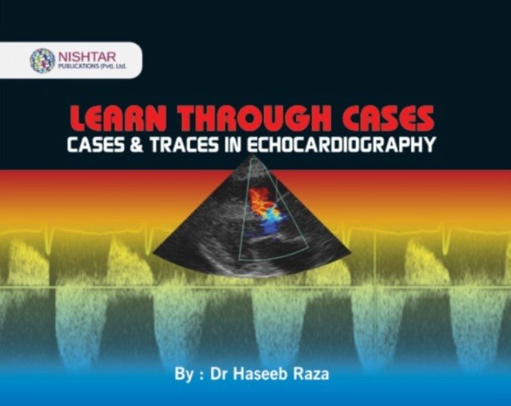 Learn-Through-Cases-Traces-in-Echocardiography-Dr-Haseeb-Raza.jpeg